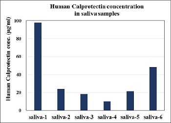 Human calprotectin concentration in saliva samples from healthy volunteers